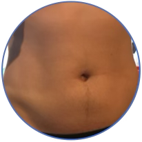 YOur abdominal therapy training